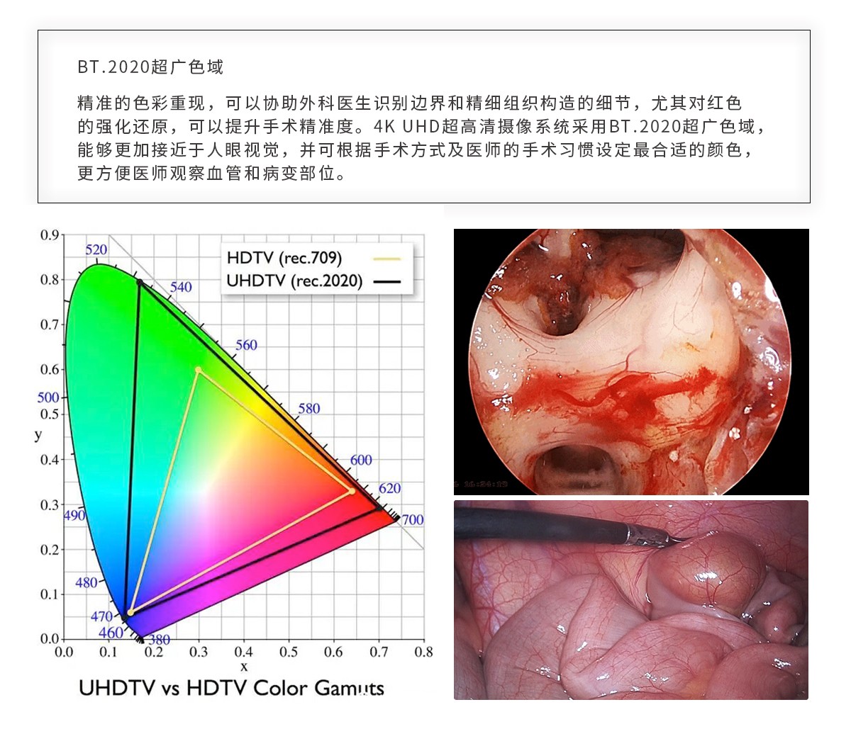 【4K醫(yī)用內(nèi)窺鏡攝像系統(tǒng)】您的第一臺(tái)“4K”找到了嗎？