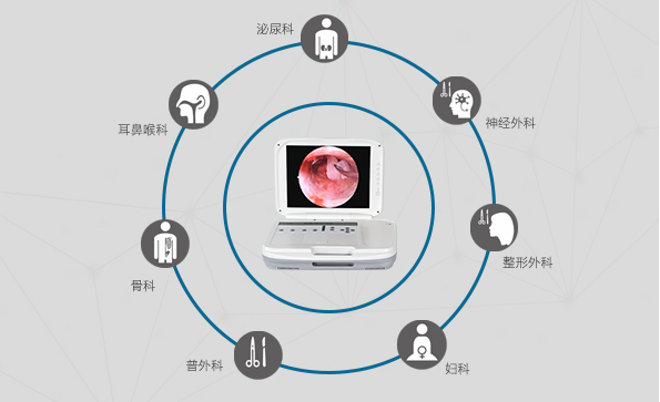 內窺鏡攝像機的應用領域有哪些？