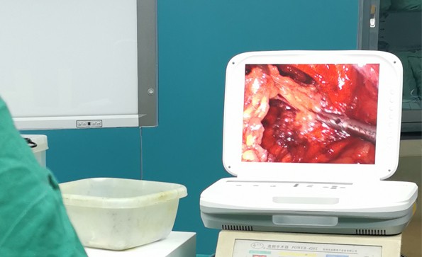 【腹腔鏡篇】腹腔鏡疝氣手術(shù)，您知道嗎？